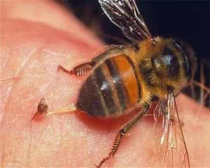 Что делать если укусила пчела, лучшие советы